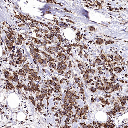 GRP75 Rabbit Polyclonal Antibody