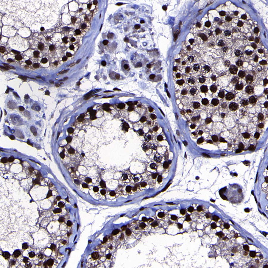 RPA3 Recombinant Rabbit mAb (S-4552-20)