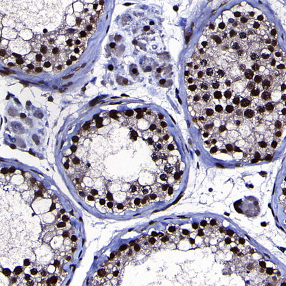 RPA3 Recombinant Rabbit mAb (S-4552-20)