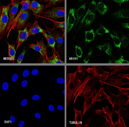 ARIH1 Recombinant Rabbit mAb (S-3166-64)