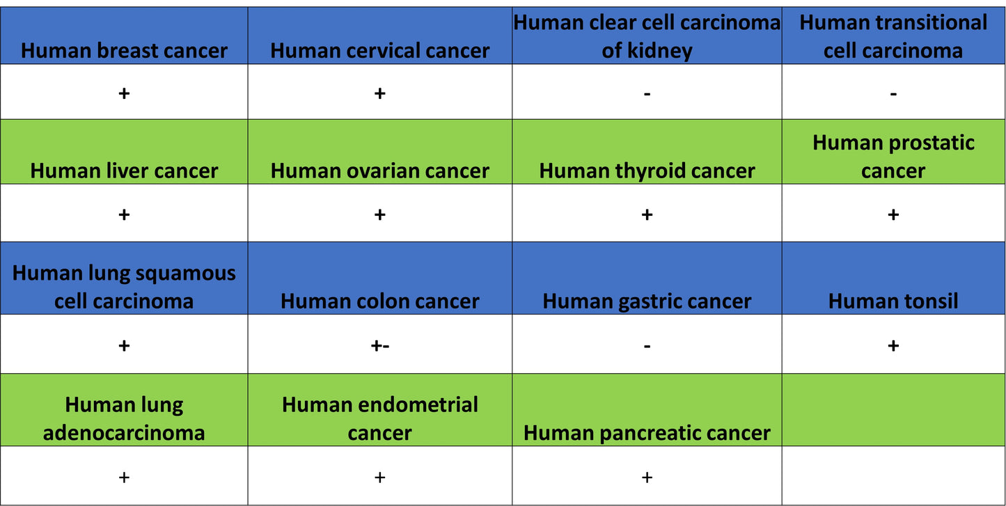 ALCAM Recombinant Rabbit mAb (S-4080-21)