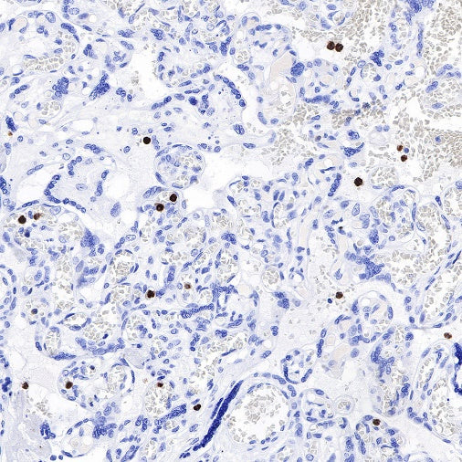 CD66b Recombinant Rabbit mAb (S-766-55)