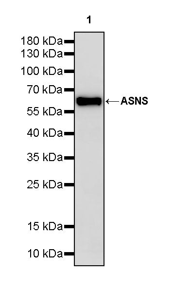 ASNS Recombinant Rabbit mAb (S-4216-14)