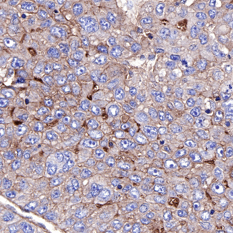 CD73 Recombinant Rabbit mAb (SDT-218-52)