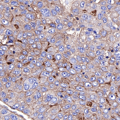 CD73 Recombinant Rabbit mAb (SDT-218-52)