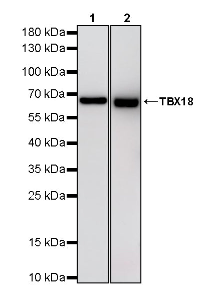 TBX18 Recombinant Rabbit mAb (S-4619-17)