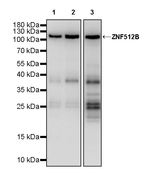 ZNF512B Recombinant Rabbit mAb (S-3432-59)
