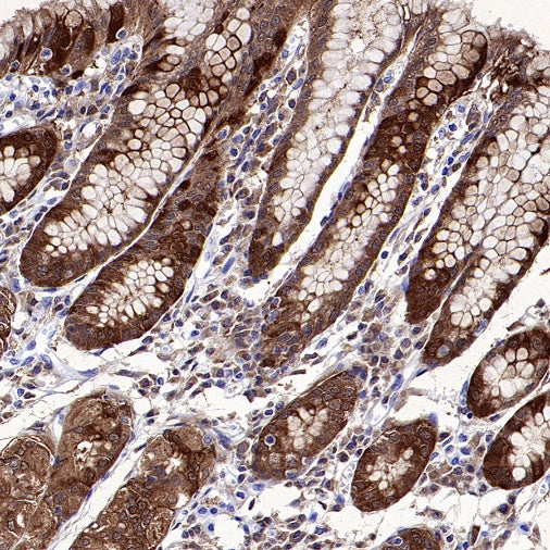 CA2 Rabbit Polyclonal Antibody
