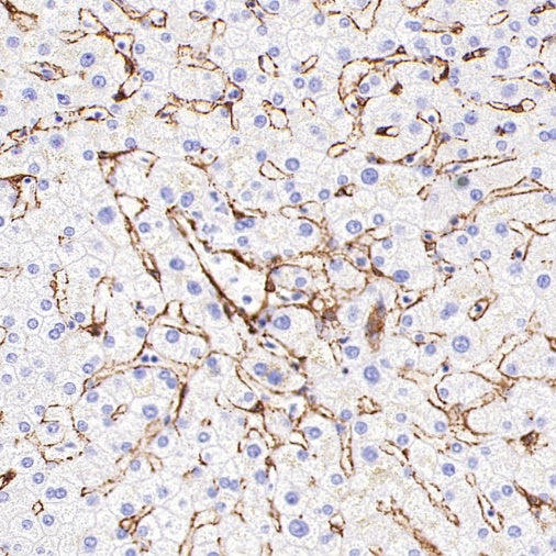 PTRF Recombinant Rabbit mAb (S-3271-13)
