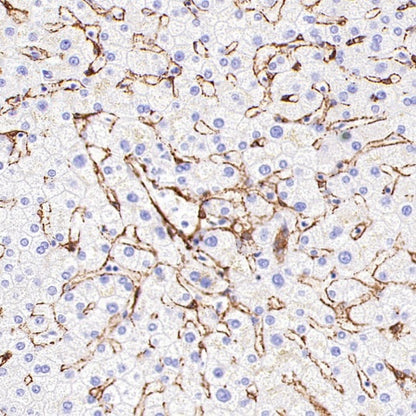 PTRF Recombinant Rabbit mAb (S-3271-13)