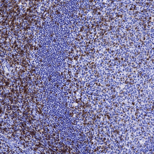 CD6 Mouse mAb (S-688-33)
