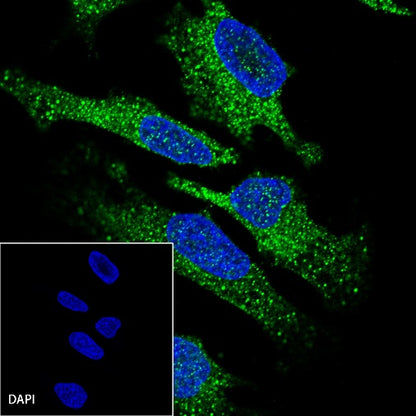 MAGE-A1 Recombinant Rabbit mAb (S-R183)