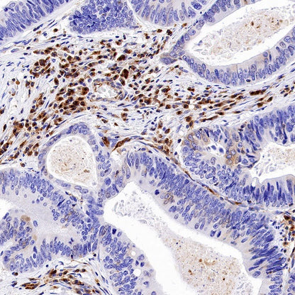 VISTA Recombinant Rabbit mAb (S-1013-5)