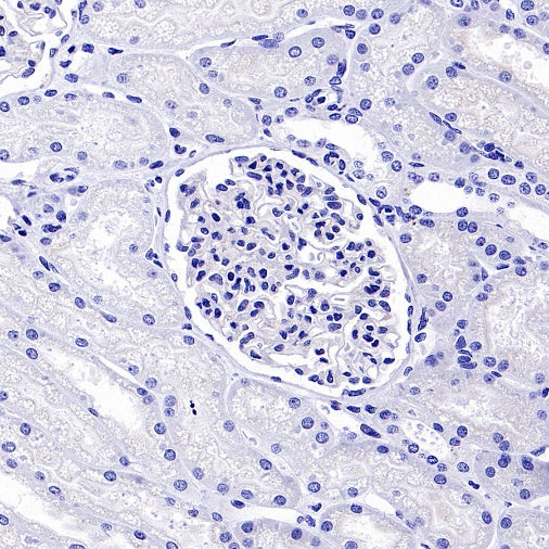 OTP Recombinant Rabbit mAb (SDT-2002-175)