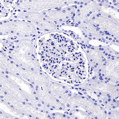 OTP Recombinant Rabbit mAb (SDT-2002-175)