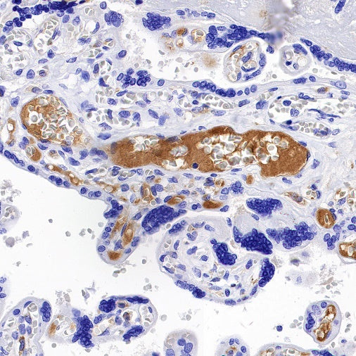 C1QB Recombinant Rabbit mAb (S-1248-314)