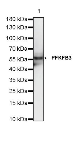 PFKFB3 Recombinant Rabbit mAb (S-653-35)
