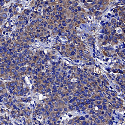 Upf1 Rabbit Polyclonal Antibody