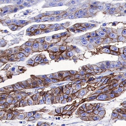 Carbonic Anhydrase 9 Recombinant Rabbit mAb (SDT-733-28)