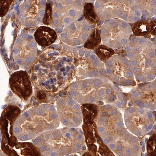 p38 MAPK Recombinant Rabbit mAb (S-508-19)
