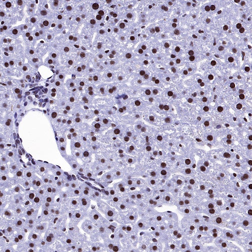 U2AF2 Recombinant Rabbit mAb (S-1324-66)