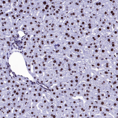 U2AF2 Recombinant Rabbit mAb (S-1324-66)