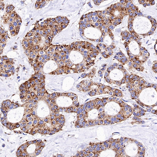 Cathepsin D Recombinant Rabbit mAb (S-R208)