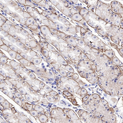 CD49f Recombinant Rabbit mAb (S-1019-73)