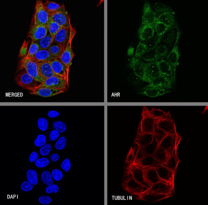 AHR Recombinant Rabbit mAb (S-2370-150)