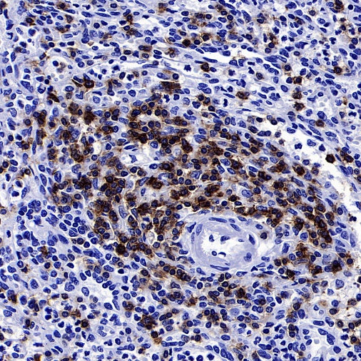CD5 Recombinant Rabbit mAb (SDT-2857-16)