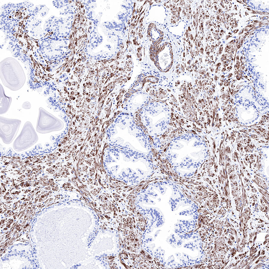 Smooth Muscle Myosin Heavy Chain (SMMHC) Recombinant Rabbit mAb (SDT-R089)