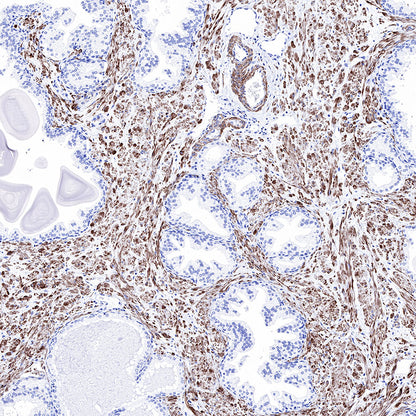 Smooth Muscle Myosin Heavy Chain (SMMHC) Recombinant Rabbit mAb (SDT-R089)