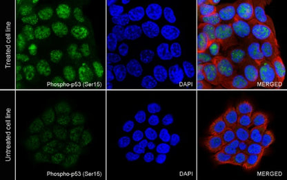 Phospho-p53 (Ser15) Rabbit Polyclonal Antibody