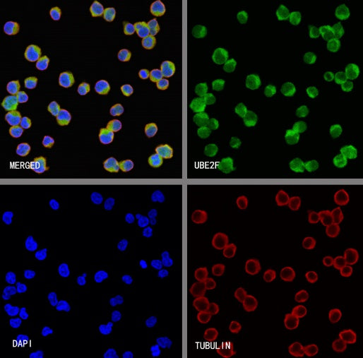 UBE2F Recombinant Rabbit mAb (S-2672-26)