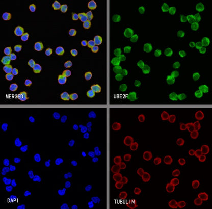 UBE2F Recombinant Rabbit mAb (S-2672-26)
