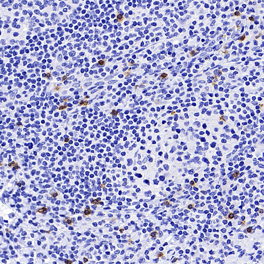 TRDC/TCR delta Recombinant Rabbit mAb (S-5148)