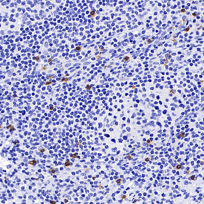 TRDC/TCR delta Recombinant Rabbit mAb (S-5148)