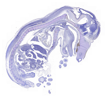 Sp7/Osterix Recombinant Rabbit mAb (S-4225-14)