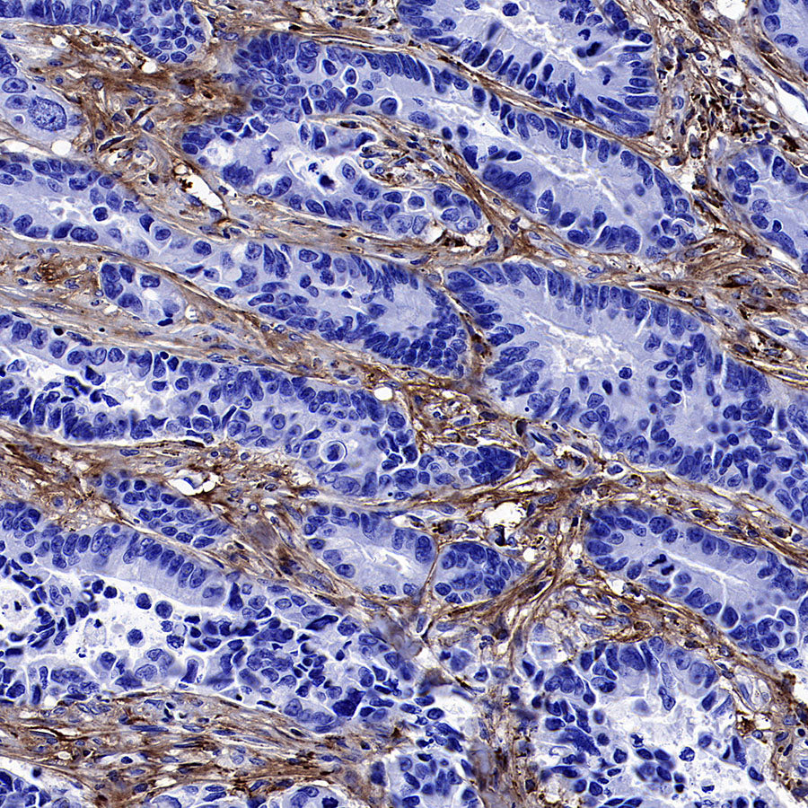 COL3A1 Recombinant Rabbit mAb (S-4338)