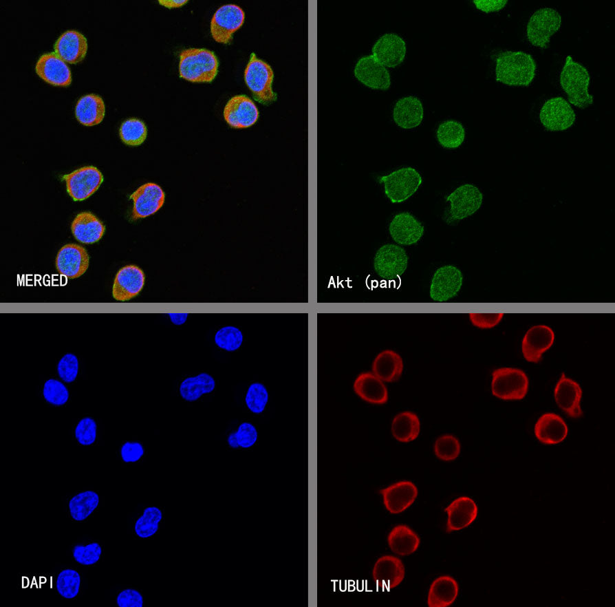 Akt (pan) Recombinant Rabbit mAb (S-652-20)