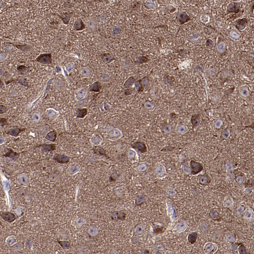 GABARAP Recombinant Rabbit mAb (S-2372-47)