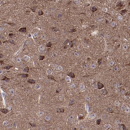 GABARAP Recombinant Rabbit mAb (S-2372-47)