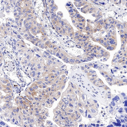 MCL1 Recombinant Rabbit mAb (S-772-109)