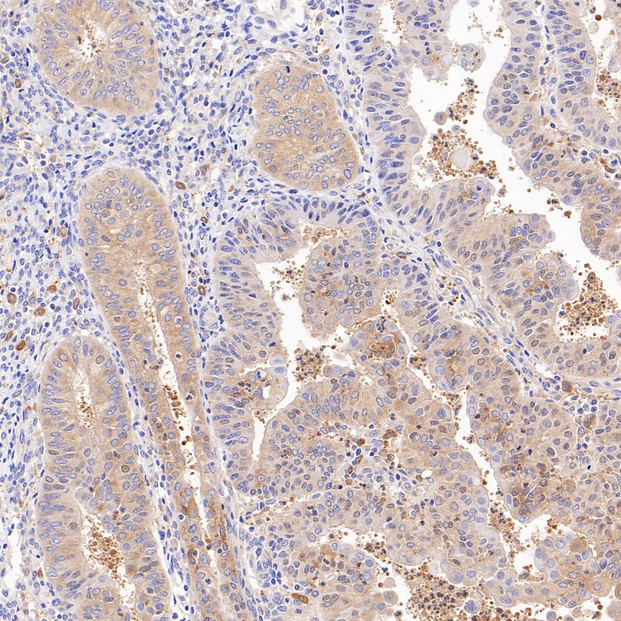 ATG7 Recombinant Rabbit mAb (S-1279-201)