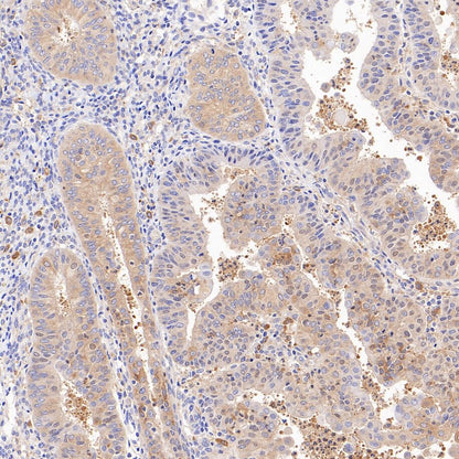 ATG7 Recombinant Rabbit mAb (S-1279-201)