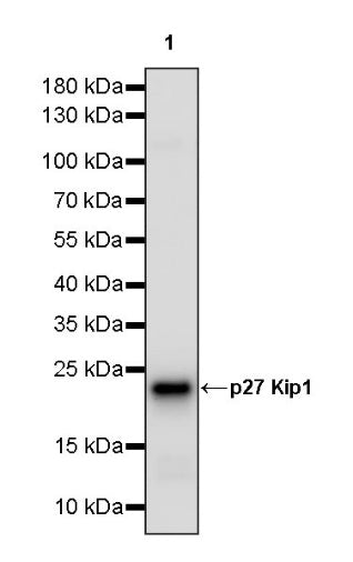 p27 Kip1 Recombinant Rabbit mAb (SDT-361-324)
