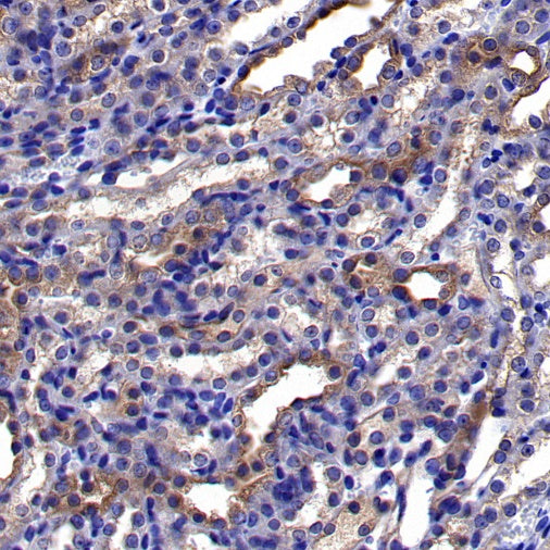 Atg5 Recombinant Rabbit mAb (S-3181)