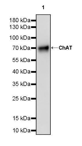 Choline Acetyltransferase/ChAT Recombinant Rabbit mAb (S-2561-17)