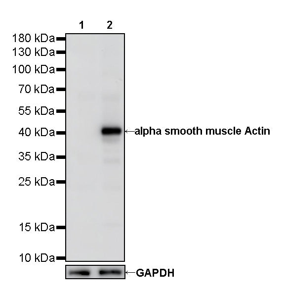 alpha smooth muscle Actin Recombinant Mouse mAb (SDT-R142)
