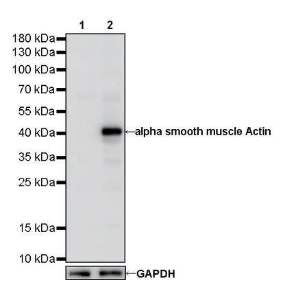 alpha smooth muscle Actin Recombinant Mouse mAb (SDT-R142)